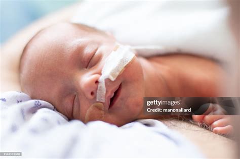 Premature infant skin and care .